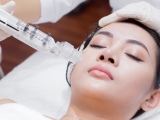 Cấy Collagen Tươi