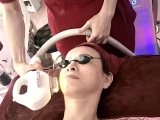 Nâng cơ trẻ hoá da công nghệ hifu