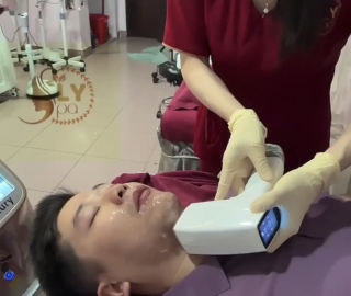 Triệt râu